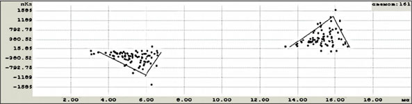 Разряд в масляном канале